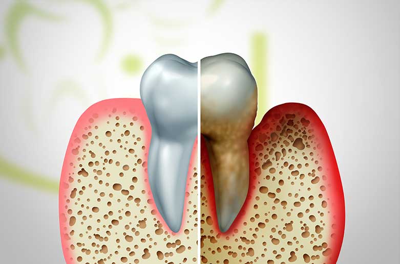 Periodontics